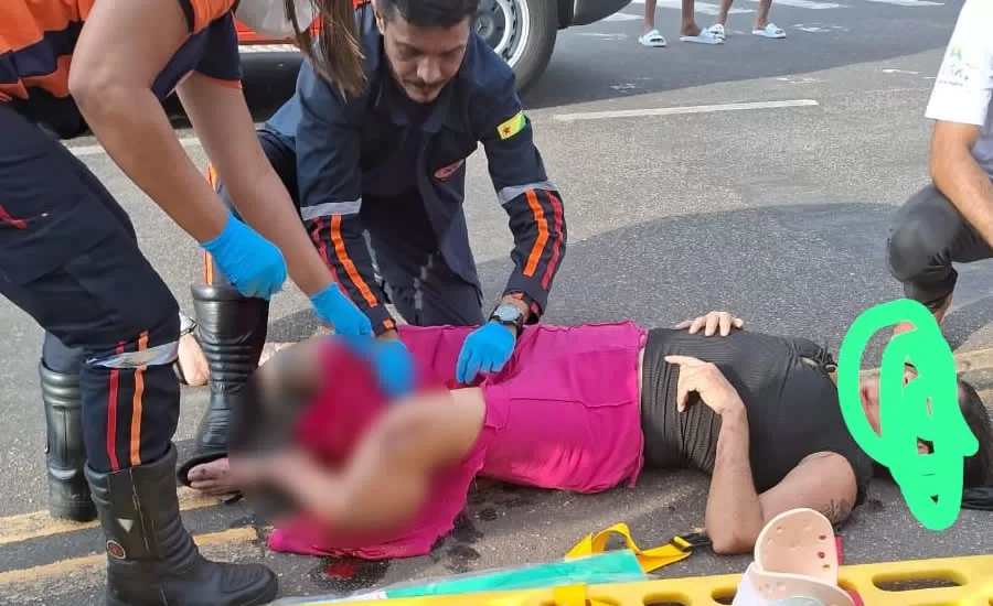 Mulher tem perna quebrada em acidente de moto e condutor foge sem prestar socorro